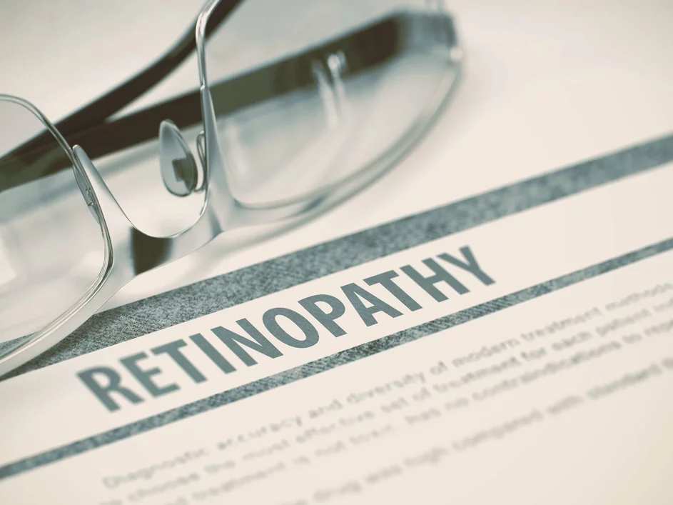 retinopatia chorioretinopatia retinopatia chorioretinopatia