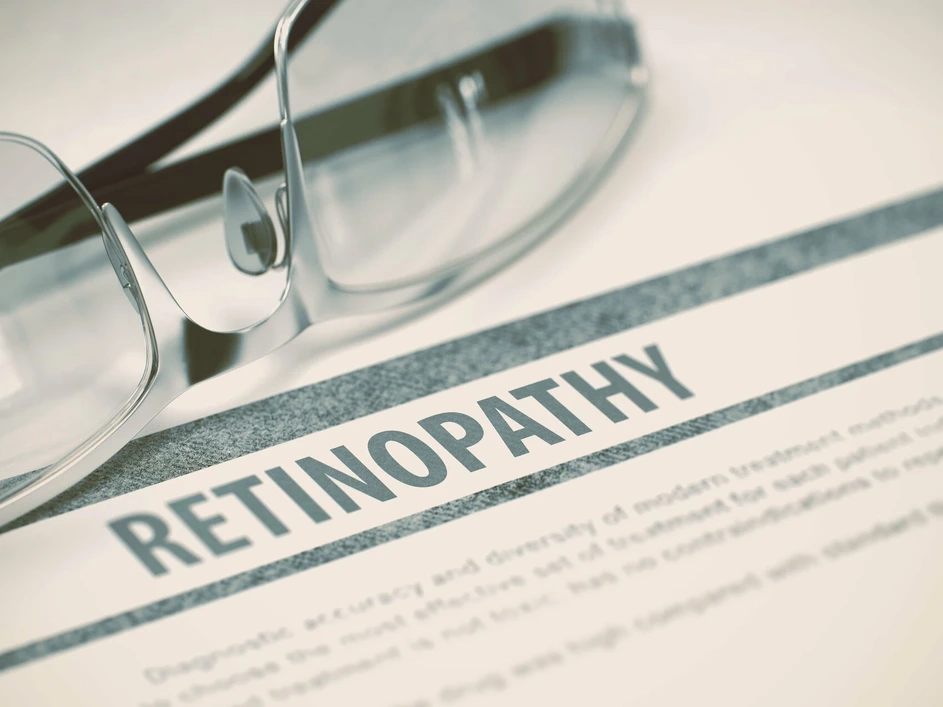 retinopatia chorioretinopatia